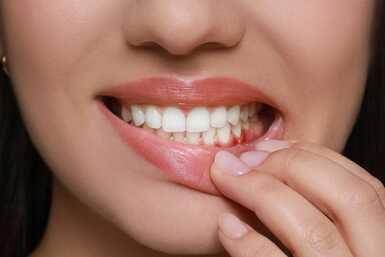 fogínyvérzés fogmosást követően