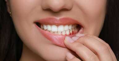 fogínyvérzés fogmosást követően